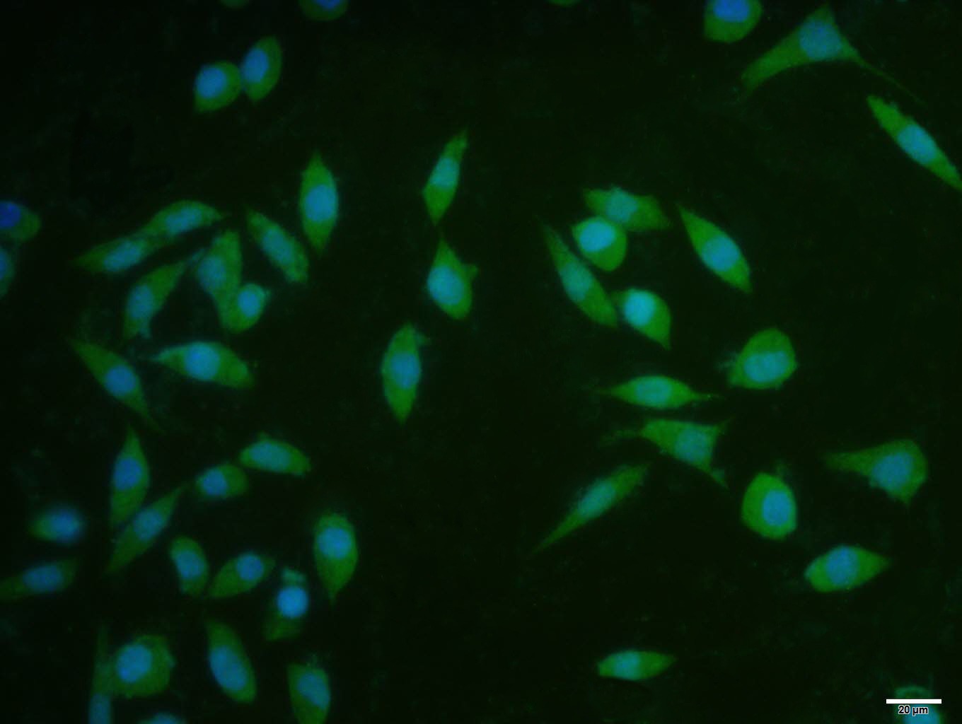 Anti-CCND1 Polyclonal Antibody 2