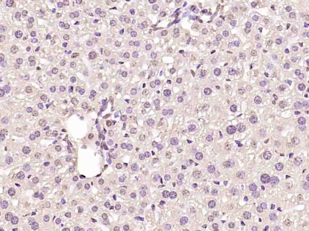 Anti-CCND1 Polyclonal Antibody 2