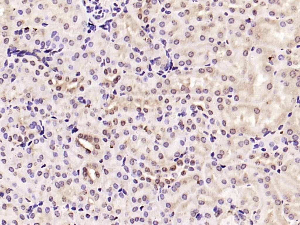 Anti-CCND1 Polyclonal Antibody 2