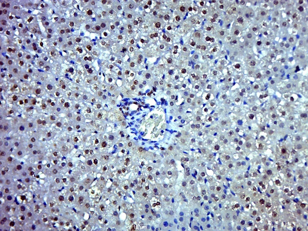 Anti-CCND1 Polyclonal Antibody 2