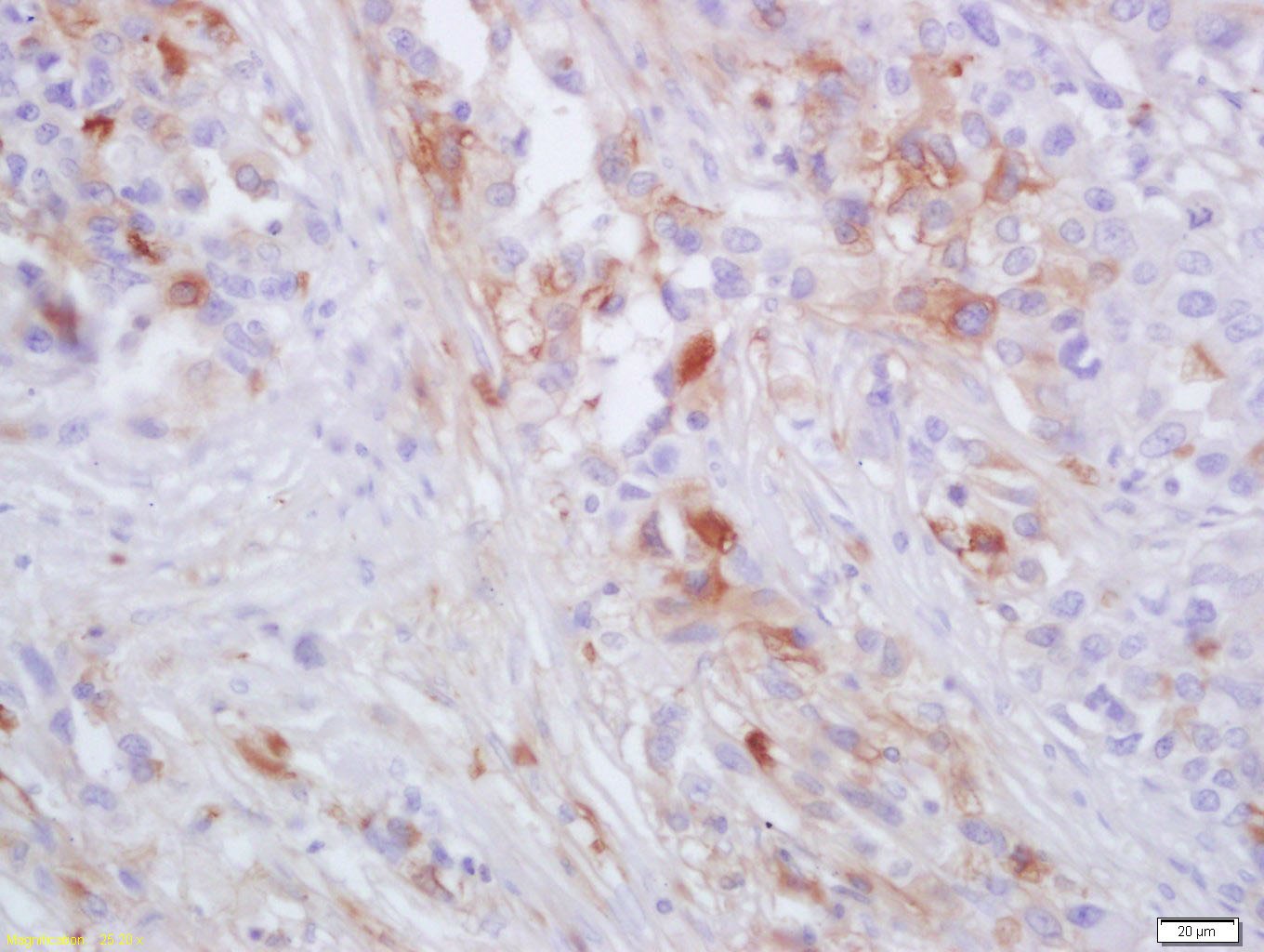 Anti-CCR2/CD192 Polyclonal Antibody
