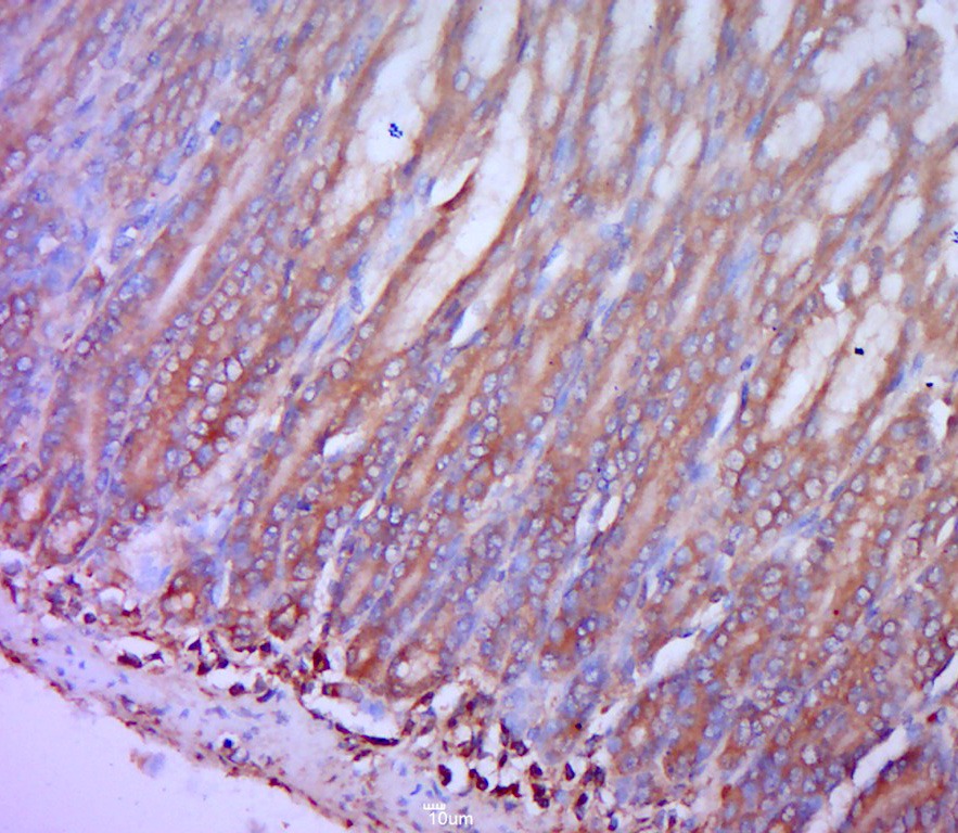 Anti-CCR2/CD192 Polyclonal Antibody 2