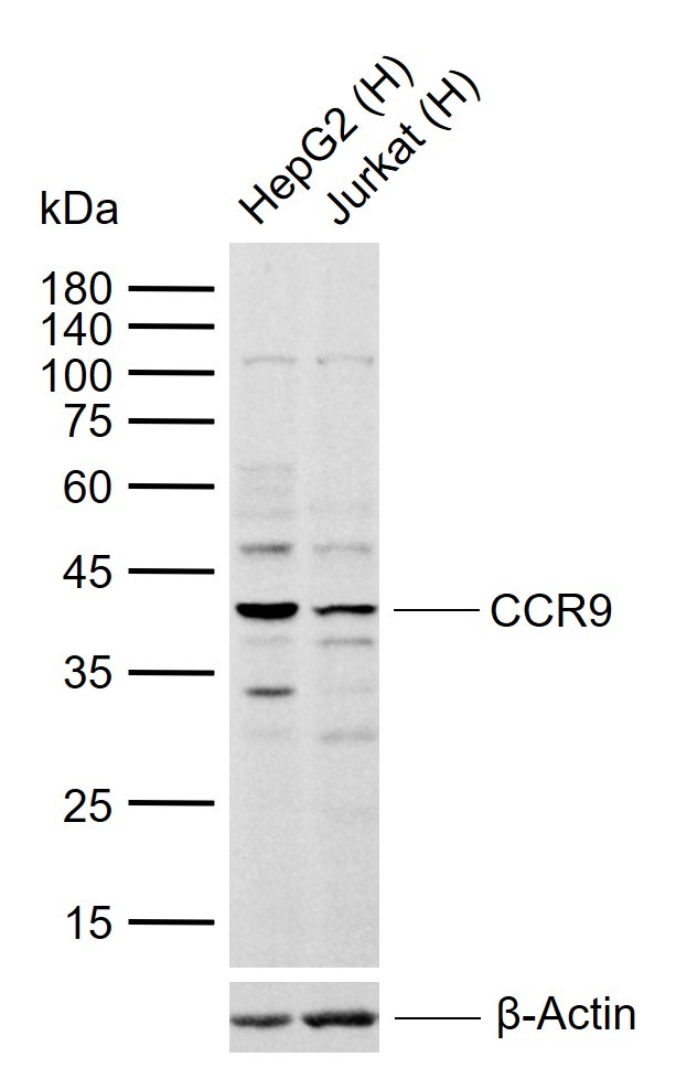 Anti-CCR9 Polyclonal Antibody