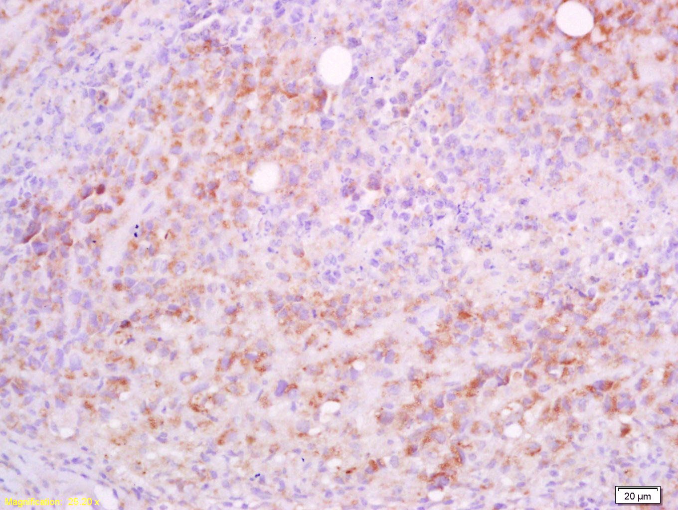Anti-CD5L Polyclonal Antibody