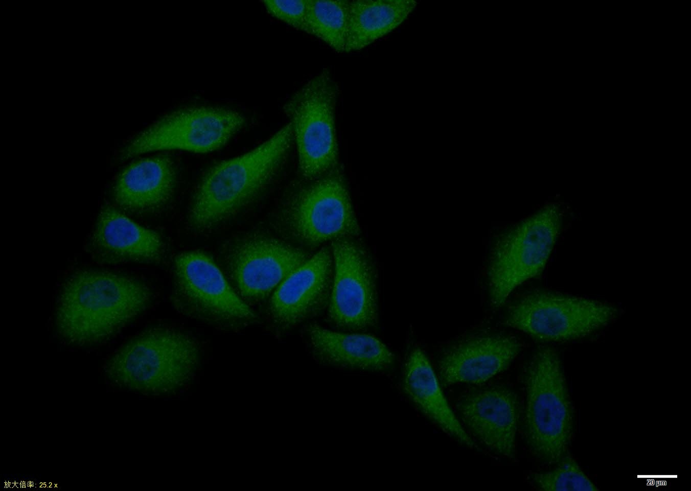 Anti-CCR7 Polyclonal Antibody