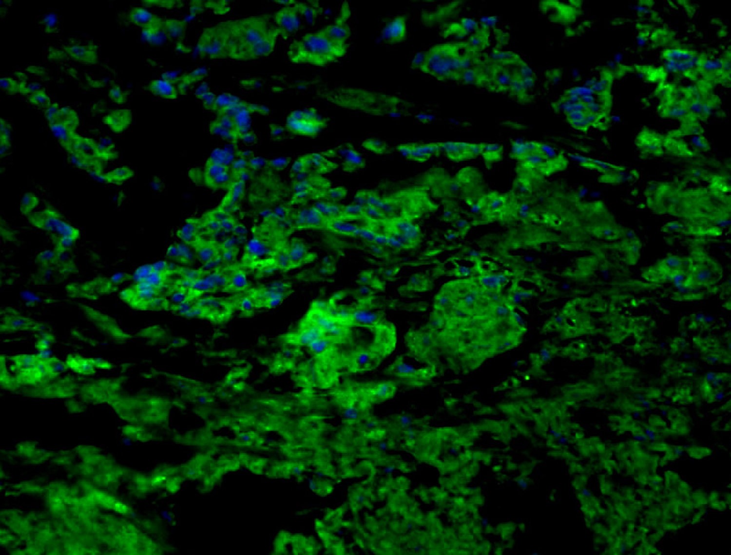 Anti-CCR7 Polyclonal Antibody