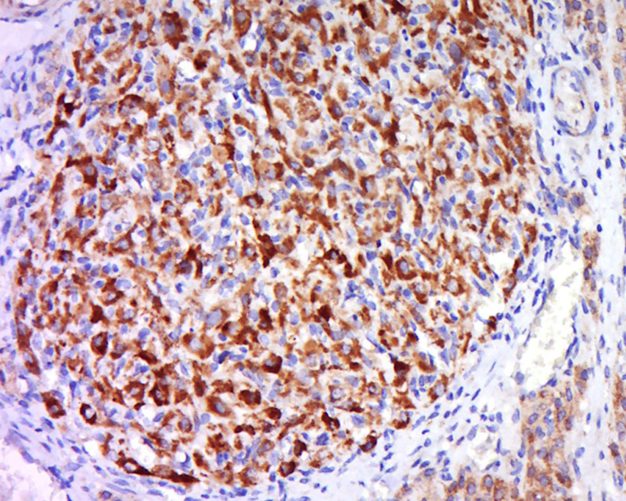 Anti-CDC42 Polyclonal Antibody
