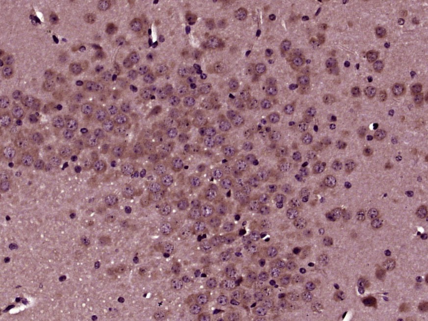 Anti-CD117 Polyclonal Antibody 2