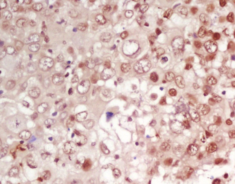 Anti-CDK1 Polyclonal Antibody