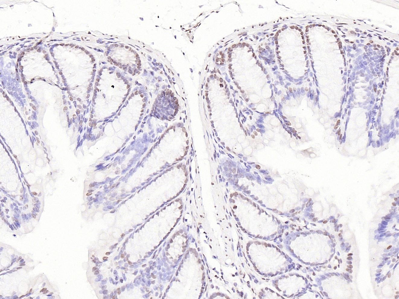 Anti-CDK1 Polyclonal Antibody