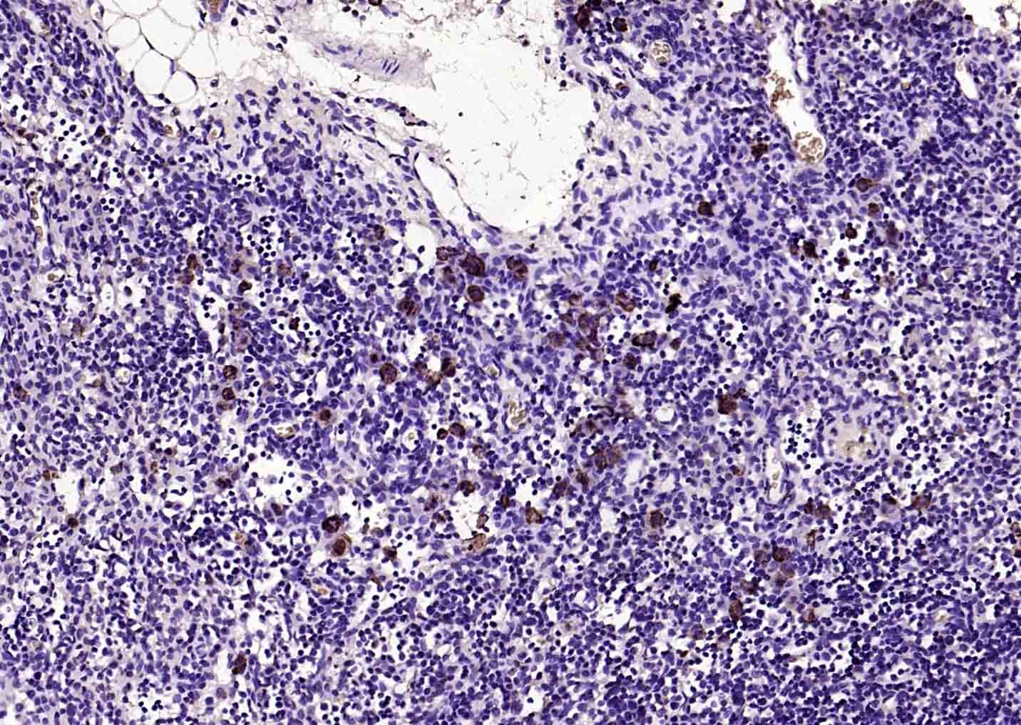 Anti-CCR7 Polyclonal Antibody