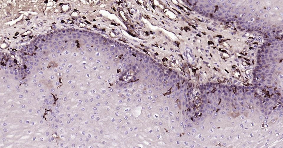Anti-CD14 Antibody (2E832)