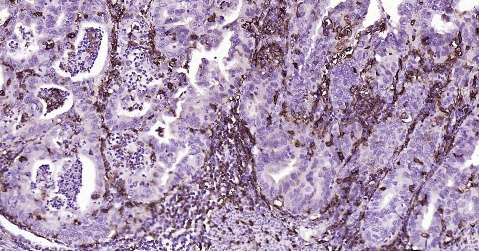 Anti-CD14 Antibody (2E832)