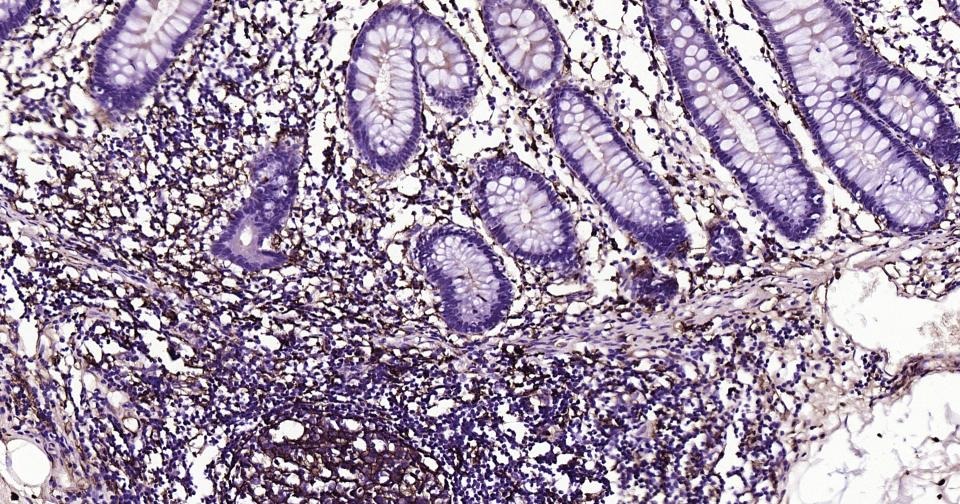 Anti-CD14 Antibody (2E832)