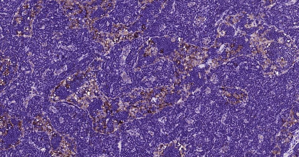 Anti-CD14 Antibody (2E832)