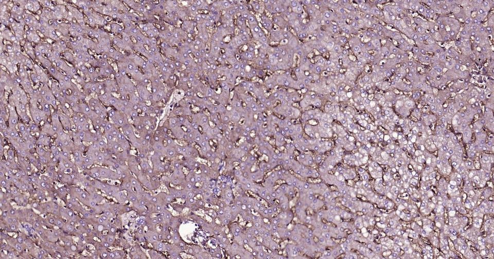 Anti-CD14 Antibody (2E832)