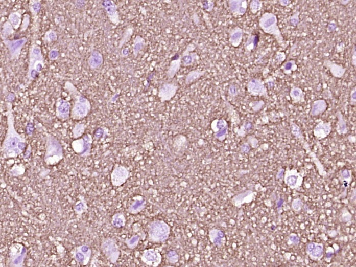 Anti-GAP43 Antibody (6V411)
