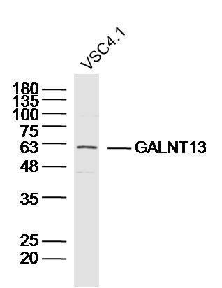 Anti-GALNT13 Polyclonal Antibody