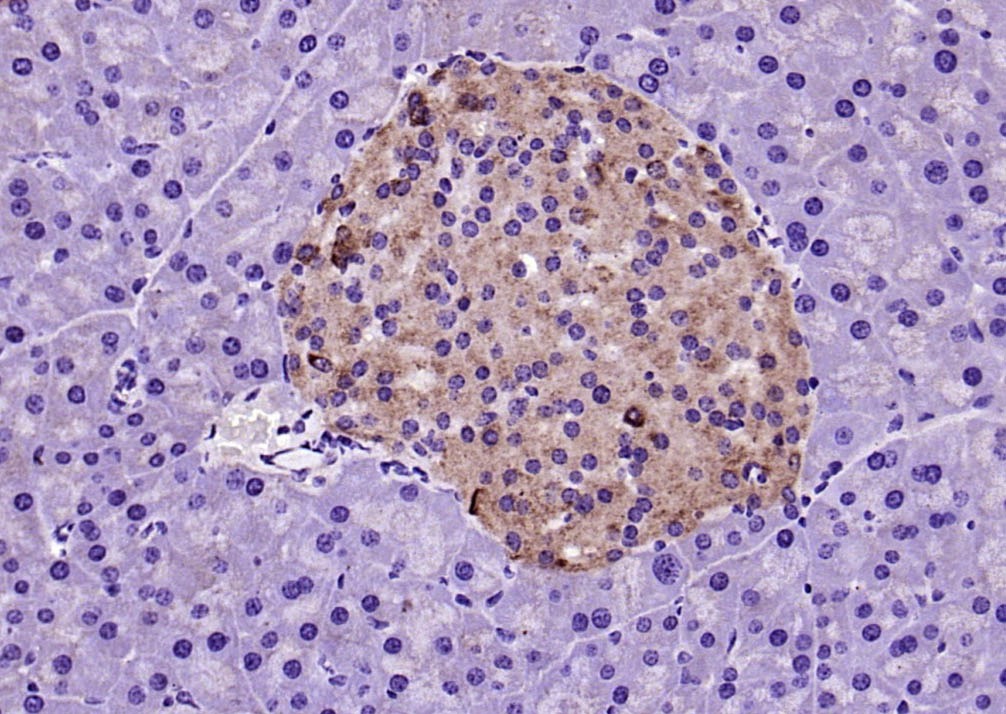 Anti-Galectin-9 Polyclonal Antibody