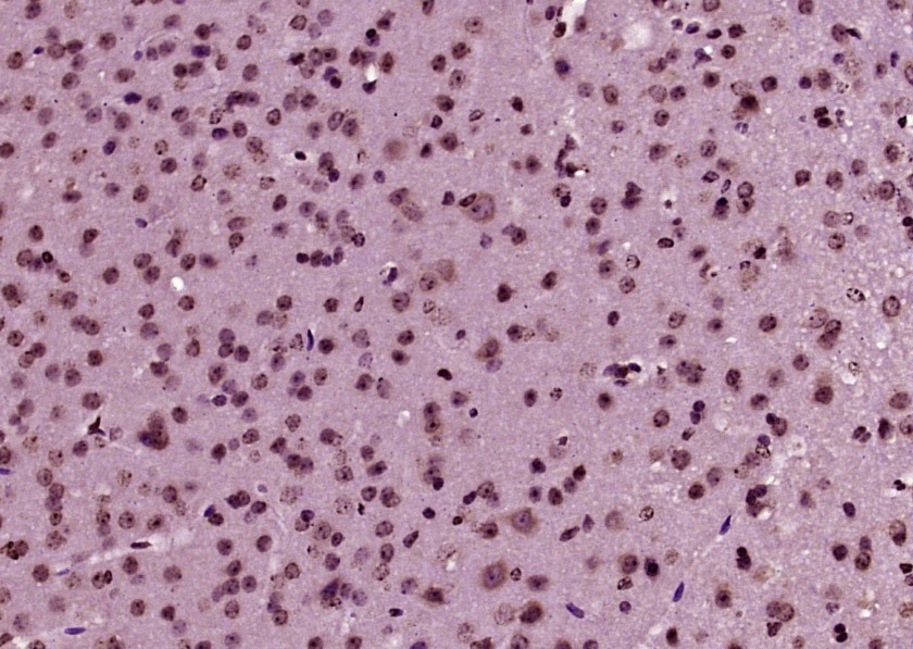 Anti-FOS Polyclonal Antibody 2