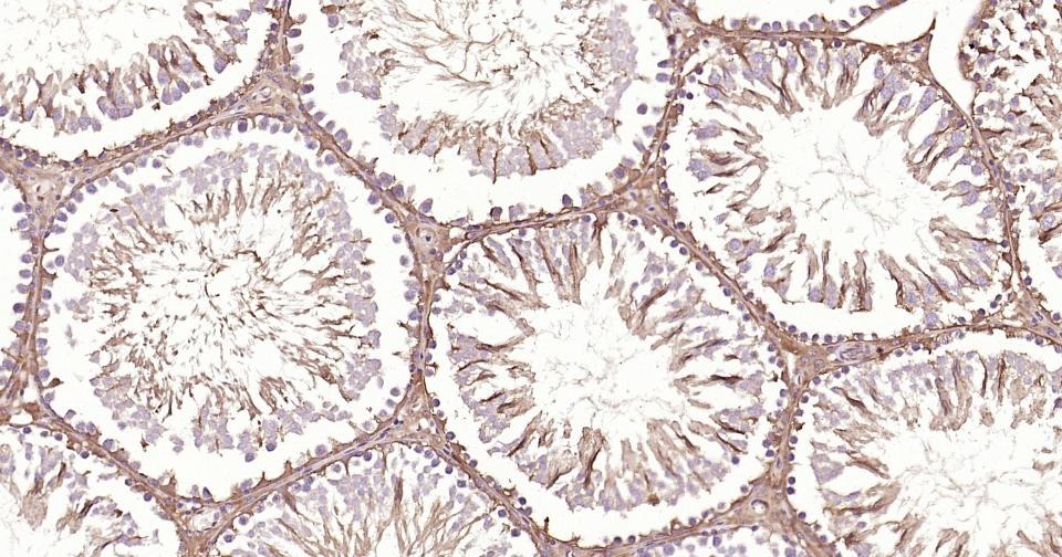 GAPDH Loading Control Polyclonal Antibody 2