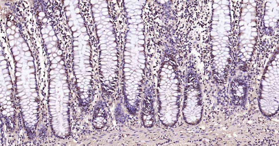 GAPDH Loading Control Polyclonal Antibody 2
