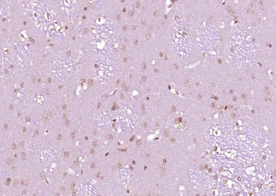 Anti-FOS Polyclonal Antibody 2