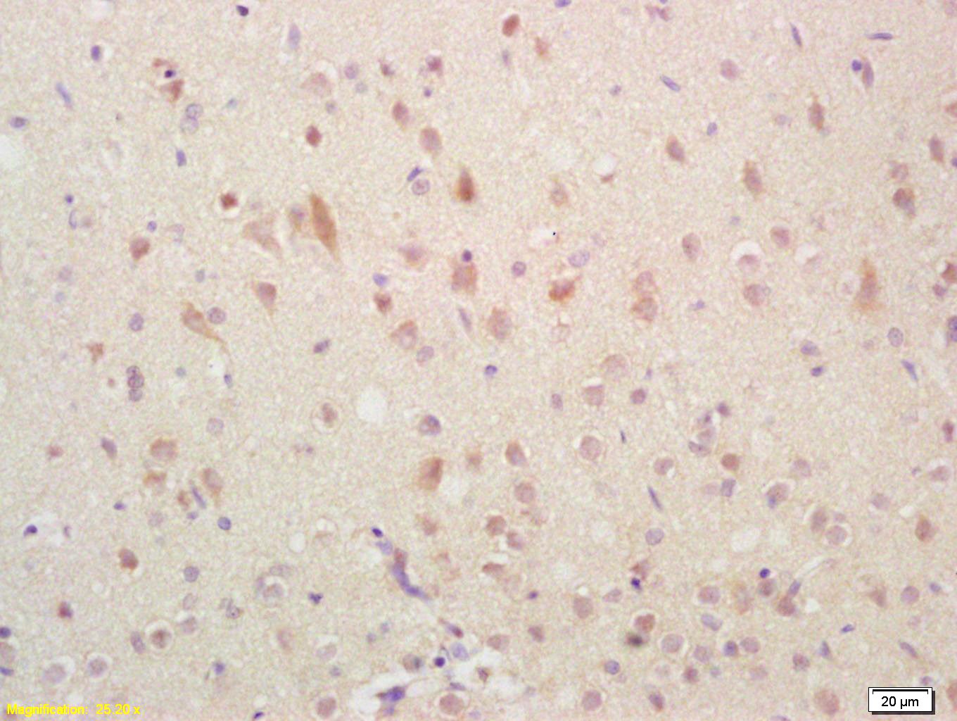 Anti-GADD45A Polyclonal Antibody