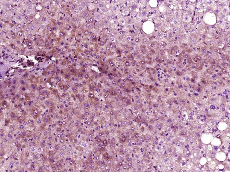 Anti-GADD45A Polyclonal Antibody