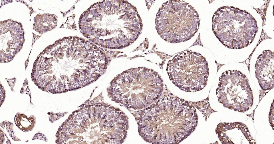GAPDH Loading Control Polyclonal Antibody 2