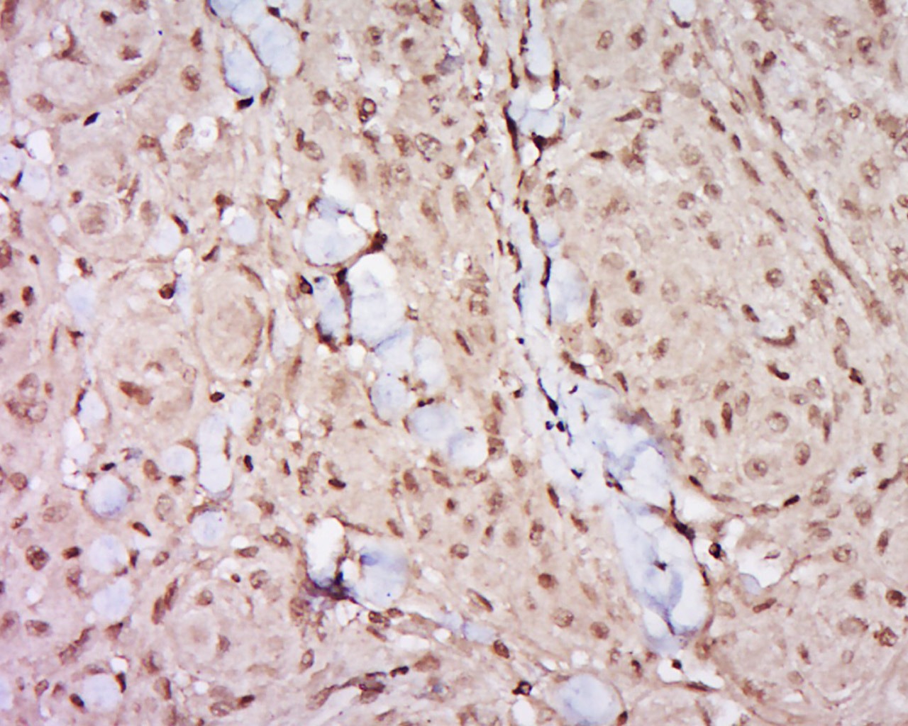 Anti-GATA3 Polyclonal Antibody
