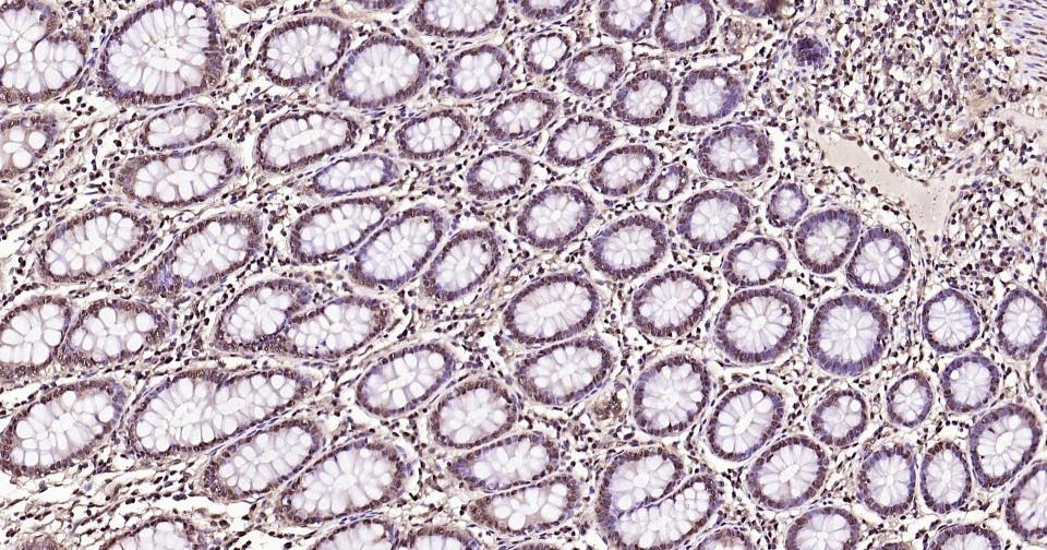 GAPDH Loading Control Antibody (1K734)