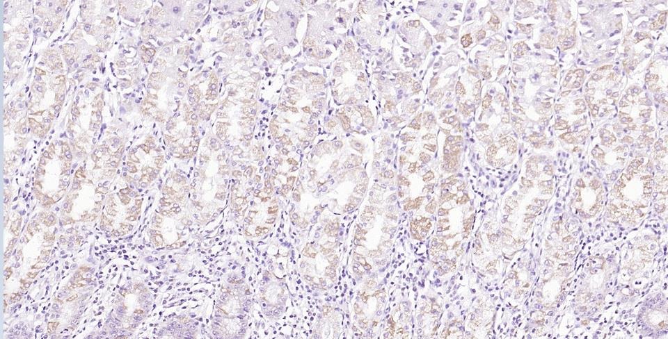 Anti-Gasdermin-C Polyclonal Antibody