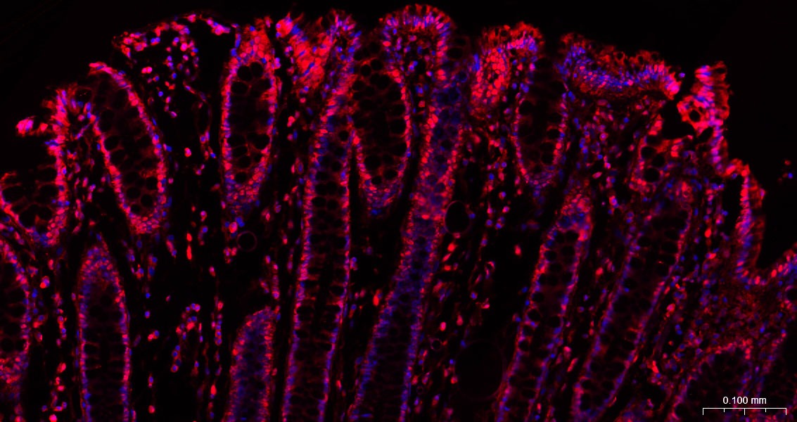 GAPDH Loading Control Polyclonal Antibody 2
