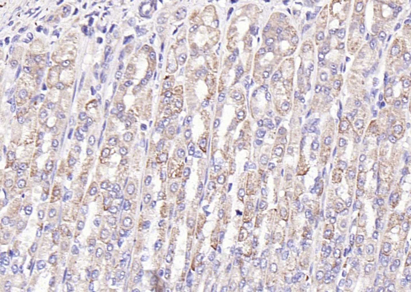 Anti-GAST Polyclonal Antibody