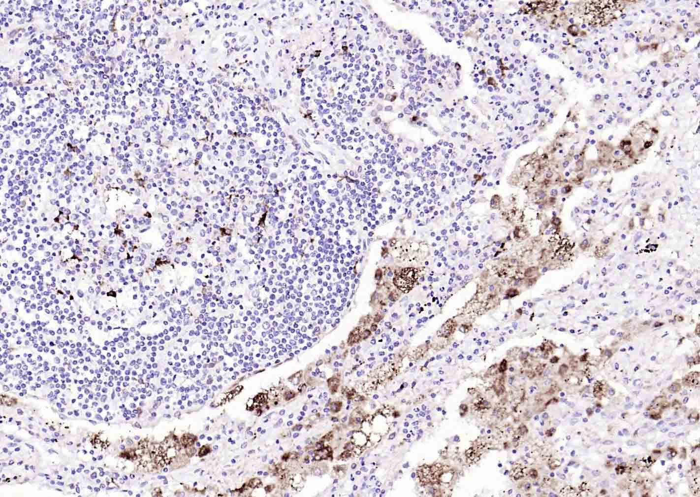 Anti-CD68 Antibody (8F211)
