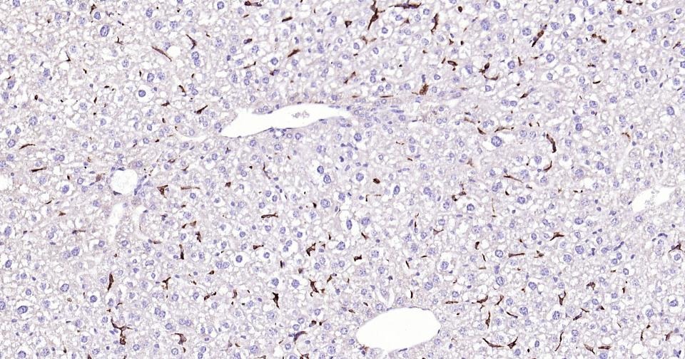 Anti-CD163 Antibody (5V810)