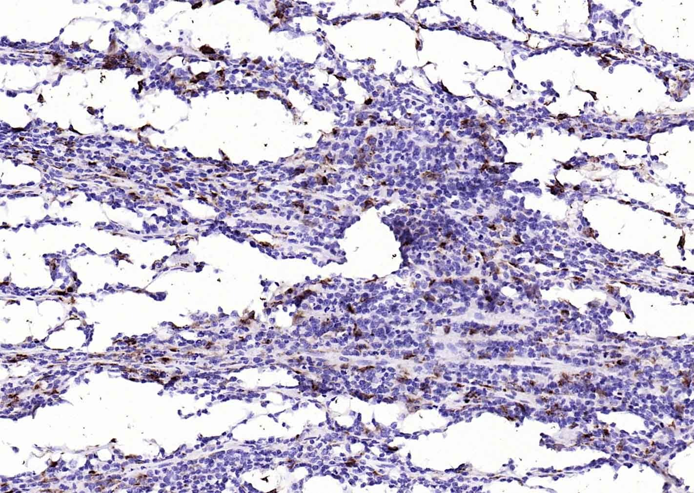 Anti-CD68 Antibody (8F211)