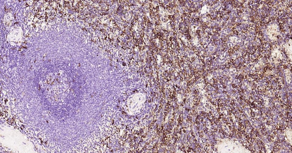 Anti-CD163 Antibody (5V810)