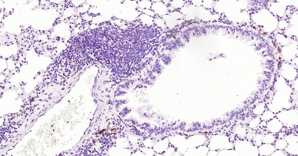 Anti-CD163 Antibody (5V810)