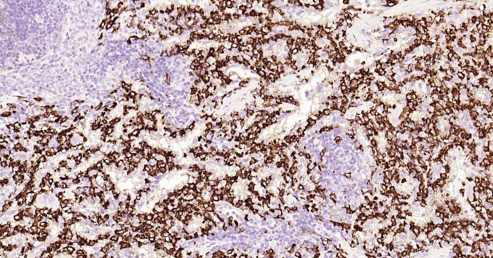 Anti-CD163 Antibody (5V810)