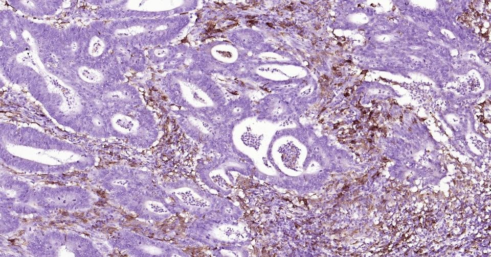 Anti-CD163 Antibody (5V810)