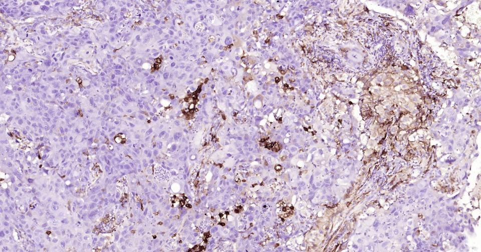 Anti-CD163 Antibody (5V810)