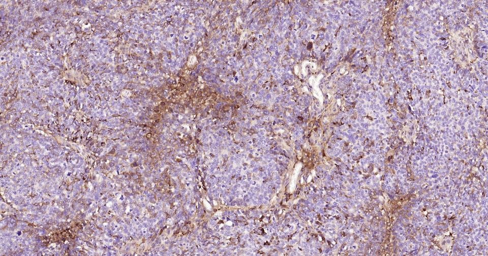 Anti-CD163 Antibody (5V810)