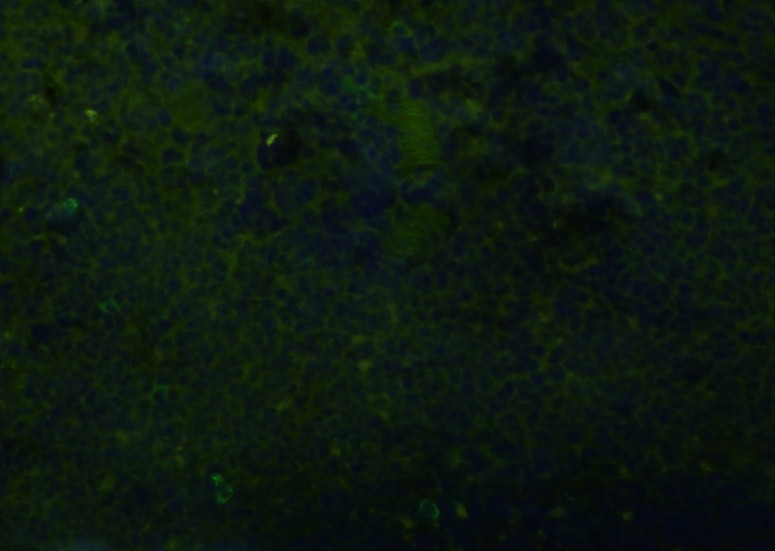 Anti-CD68 Polyclonal Antibody 3
