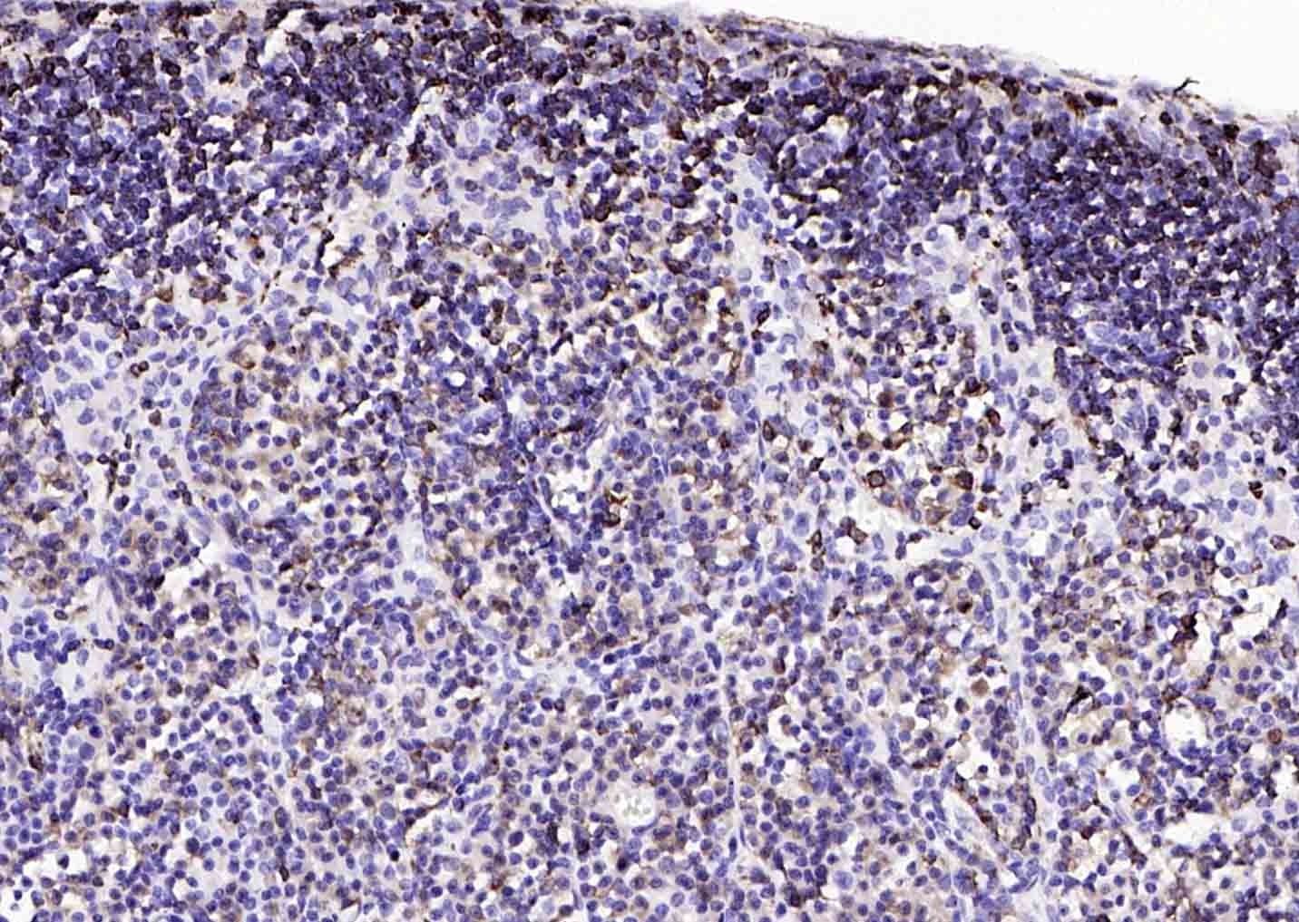 Anti-CD74 Polyclonal Antibody