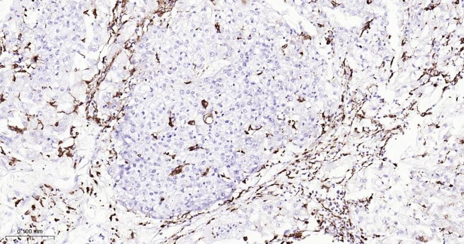 Anti-CD68 Antibody (2P747)