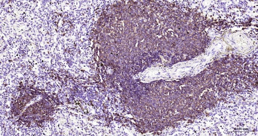 Anti-CD20 Antibody (1R324)