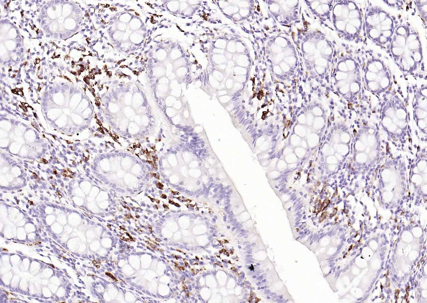 Anti-CD68 Polyclonal Antibody