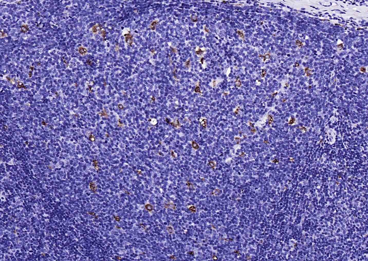 Anti-CD68 Polyclonal Antibody